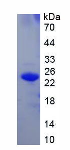 Recombinant Interleukin 17D (IL17D)