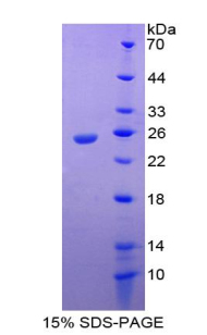 Recombinant Interleukin 17 Receptor E (IL17RE)