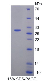 Recombinant Interleukin 17 Receptor C (IL17RC)