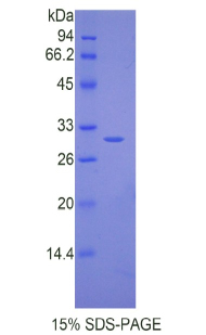 Recombinant Interleukin 17 Receptor C (IL17RC)