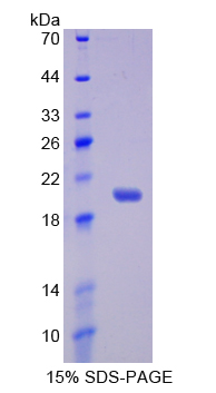 Recombinant Interleukin 17 Receptor B (IL17RB)