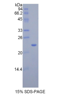 Recombinant Interleukin 17 Receptor B (IL17RB)