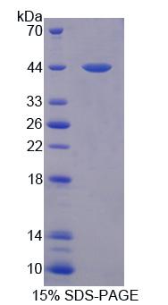 Recombinant Kruppel Like Factor 15 (KLF15)