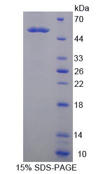 Recombinant Kallikrein 14 (KLK14)