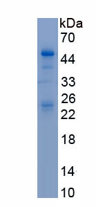 Recombinant Neuroserpin (NSP)