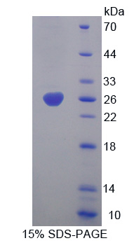 Recombinant Leukocyte Elastase Inhibitor (LEI)