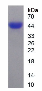 Recombinant Dickkopf Related Protein 3 (DKK3)