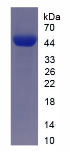 Recombinant Dickkopf Related Protein 3 (DKK3)