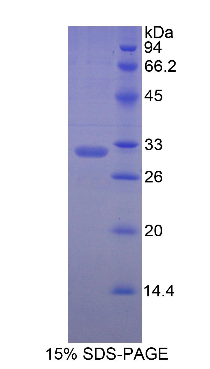 Recombinant Myosin Heavy Chain 7, Cardiac Muscle, Beta (MYH7)