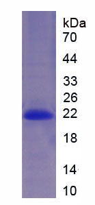 Recombinant Myosin Heavy Chain 7, Cardiac Muscle, Beta (MYH7)