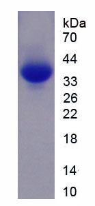 Recombinant Myosin Heavy Chain 6, Cardiac Muscle, Alpha (MYH6)