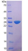 Recombinant Myosin Heavy Chain 6, Cardiac Muscle, Alpha (MYH6)