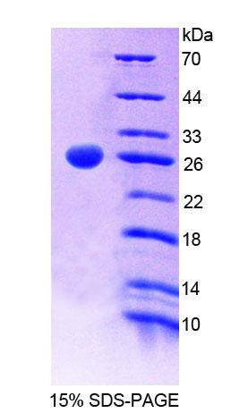 Recombinant Myosin Heavy Chain 11, Smooth Muscle (MYH11)