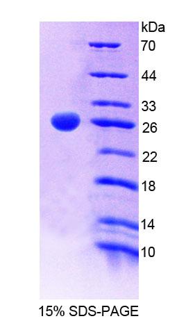 Recombinant Myosin Heavy Chain 11, Smooth Muscle (MYH11)