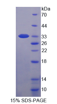 Recombinant Myosin Light Chain Kinase 2 (MYLK2)