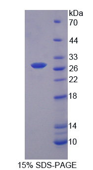 Recombinant Myosin Light Chain Kinase 2 (MYLK2)