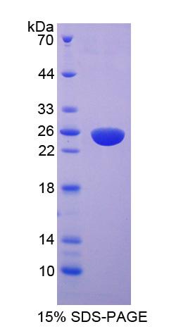 Recombinant Myosin Light Chain Kinase 2 (MYLK2)