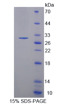 Recombinant Myosin Light Chain Kinase 3 (MYLK3)