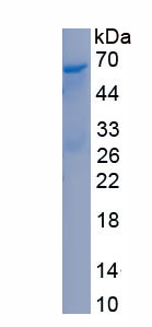 Recombinant Myosin Light Chain Kinase 4 (MYLK4)