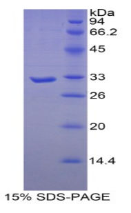 Recombinant Myosin Heavy Chain 16 (MYH16)