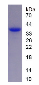 Recombinant Hypoxia Inducible Factor 2 Alpha (HIF2a)