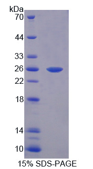 Recombinant Aryl Hydrocarbon Receptor Nuclear Translocator Like Protein (ARNTL)