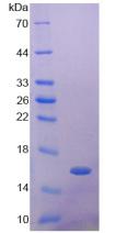 Recombinant Glucagon Like Peptide 1 Receptor (GLP1R)