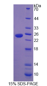 Recombinant Heat Shock Protein Beta 7 (HSPb7)