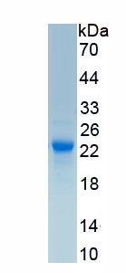 Recombinant Cytochrome P450 46A1 (CYP46A1)