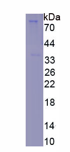 Recombinant Cytochrome P450 27A1 (CYP27A1)