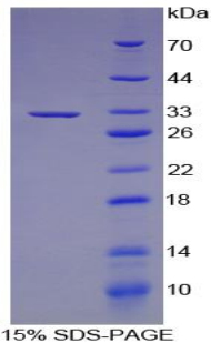 Recombinant Cytochrome P450 27B1 (CYP27B1)