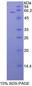 Recombinant Mitogen Activated Protein Kinase Kinase 4 (MAP2K4)