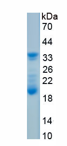 Recombinant Protein Tyrosine Phosphatase, Non Receptor Type 18 (PTPN18)