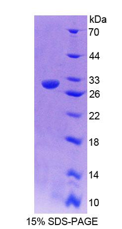 Recombinant Protein Tyrosine Phosphatase, Non Receptor Type 22 (PTPN22)