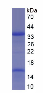 Recombinant Protein Tyrosine Phosphatase, Non Receptor Type 22 (PTPN22)