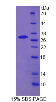 Recombinant ATP Binding Cassette Transporter C4 (ABCC4)