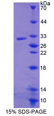 Recombinant ATP Binding Cassette Transporter C11 (ABCC11)