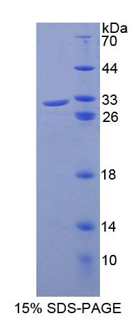 Recombinant ATP Binding Cassette Transporter B8 (ABCB8)