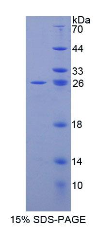 Recombinant ATP Binding Cassette Transporter D2 (ABCD2)