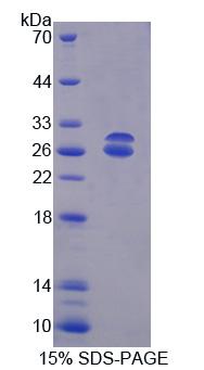 Recombinant ATP Binding Cassette Transporter G5 (ABCG5)