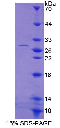 Recombinant Acetyl Coenzyme A Acyltransferase 1 (ACAA1)