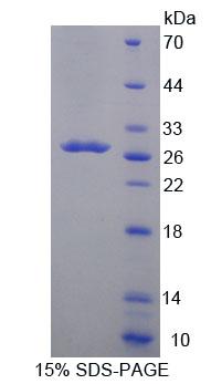 Recombinant Acyl Coenzyme A Dehydrogenase, Long Chain (ACADL)
