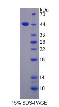 Recombinant Acetyl Coenzyme A Acetyltransferase 1 (ACAT1)