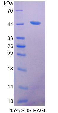 Recombinant Acetyl Coenzyme A Acetyltransferase 2 (ACAT2)