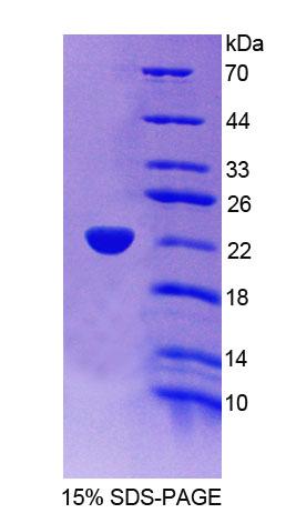 Recombinant Acyl Coenzyme A Oxidase 3, Pristanoyl (ACOX3)