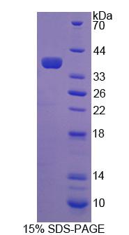 Recombinant Coenzyme A Synthase (COASY)