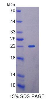 Recombinant Glutaryl Coenzyme A Dehydrogenase (GCDH)