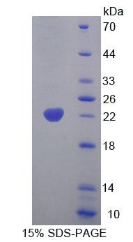 Recombinant Glutaryl Coenzyme A Dehydrogenase (GCDH)