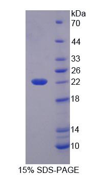 Recombinant Hydroxyacyl Coenzyme A Dehydrogenase (HADH)