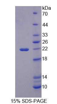 Recombinant 3-Hydroxyisobutyryl Coenzyme A Hydrolase (HIBCH)